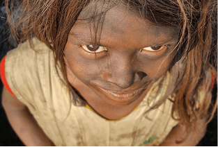 Supporting lives in Dhanbad - row 2 image 2